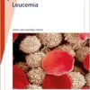 Fast Facts: Leucemia (Spanish Edition) (EPUB)