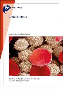 Fast Facts: Leucemia (Spanish Edition) (EPUB)