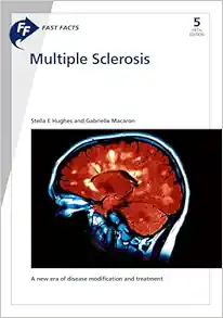 Multiple Sclerosis (Fast Facts), 5th Edition (EPUB)