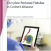 Fast Facts: Complex Perianal Fistulas in Crohn’s Disease (EPUB)