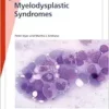 Fast Facts: Myelodysplastic Syndromes (PDF )