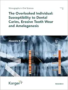 The Overlooked Individual: Susceptibility to Dental Caries, Erosive Tooth Wear and Amelogenesis (Monographs In Oral Science, 30) (PDF )