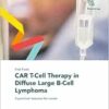 Fast Facts: CAR T-Cell Therapy in Diffuse Large B-Cell Lymphoma (EPUB)