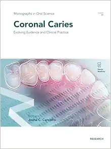 Coronal Caries (Monographs In Oral Science, 31) (EPUB)