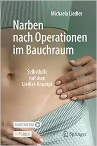 Narben nach Operationen im Bauchraum: Selbsthilfe mit dem Liedler-Konzept (German Edition) (PDF )