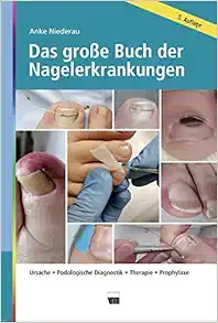 Das große Buch der Nagelerkrankungen: Ursache, Podologische Diagnostik, Therapie, Prophylaxe, 5th Edition (EPUB)