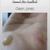 Warts And Moles: Understanding And Managing These Common Skin Conditions (EPUB)