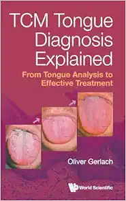 TCM Tongue Diagnosis Explained: From Tongue Analysis to Effective Treatment (PDF)