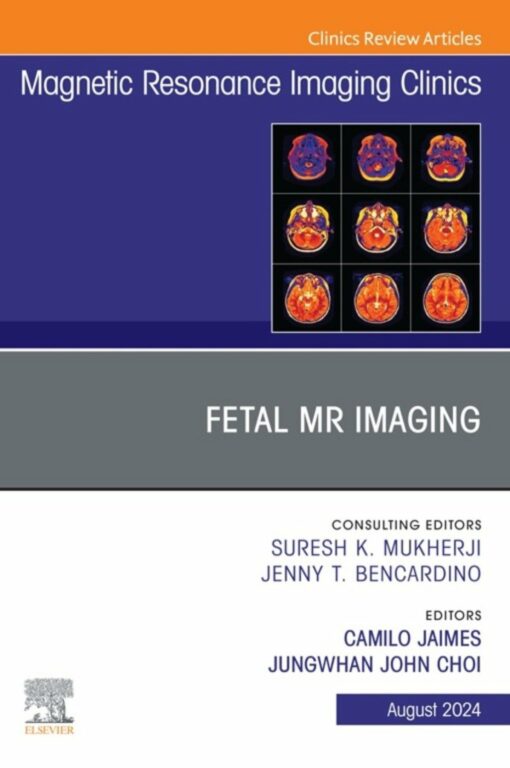 Fetal MRI, An Issue of Magnetic Resonance Imaging Clinics of North America (True PDF)