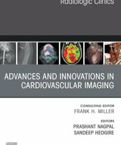 Advances and Innovations in Cardiovascular Imaging, An Issue of Radiologic Clinics of North America (True PDF )