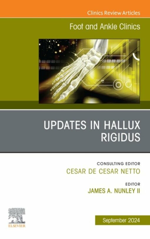 Updates in Hallux Rigidus, An issue of Foot and Ankle Clinics of North America (True PDF )