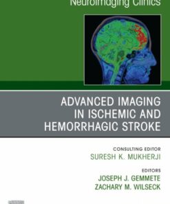 Advanced Imaging in Ischemic and Hemorrhagic Stroke, An Issue of Neuroimaging Clinics of North America (True PDF )