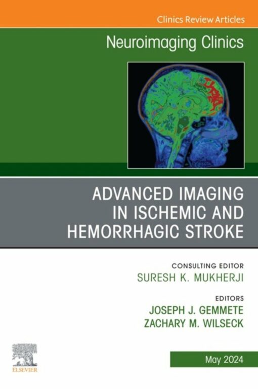 Advanced Imaging in Ischemic and Hemorrhagic Stroke, An Issue of Neuroimaging Clinics of North America (True PDF )