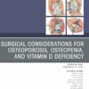 Surgical Considerations for Osteoporosis, Osteopenia, and Vitamin D Deficiency, An Issue of Orthopedic Clinics (True PDF )