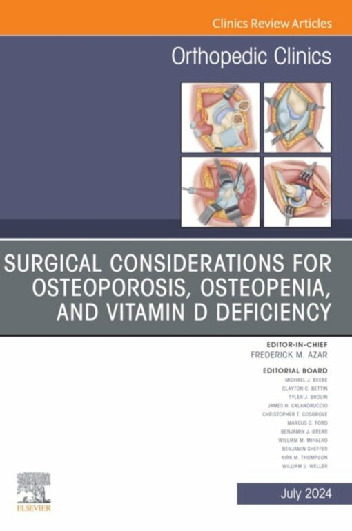 Surgical Considerations for Osteoporosis, Osteopenia, and Vitamin D Deficiency, An Issue of Orthopedic Clinics (True PDF )