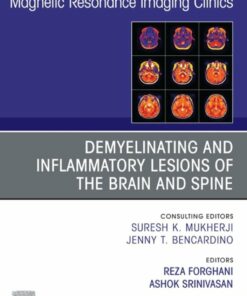 Demyelinating and Inflammatory Lesions of the Brain and Spine, An Issue of Magnetic Resonance Imaging Clinics of North America (True PDF )