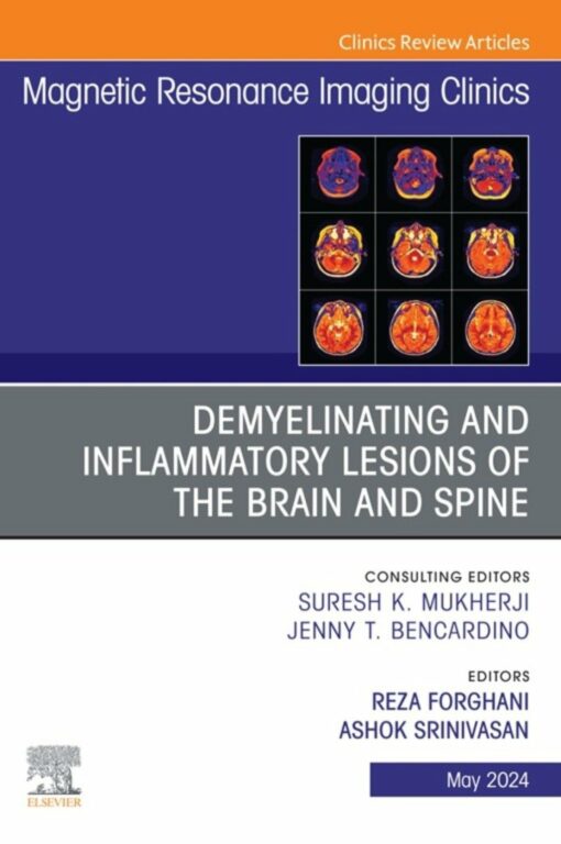 Demyelinating and Inflammatory Lesions of the Brain and Spine, An Issue of Magnetic Resonance Imaging Clinics of North America (True PDF )