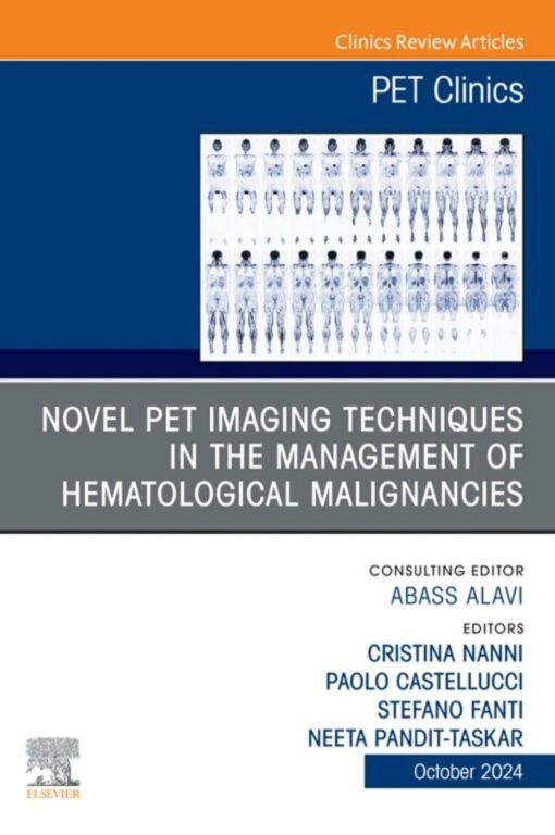 Novel PET Imaging Techniques in the Management of Hematologic Malignancies, An Issue of PET Clinics (True PDF)