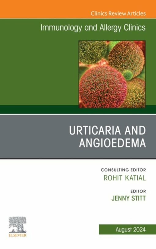 Urticaria and Angioedema, An Issue of Immunology and Allergy Clinics of North America (True PDF )