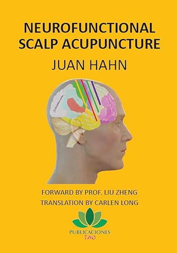 Neurofunctional scalp acupuncture