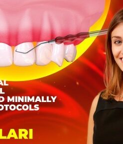 OHI-S Non-Surgical Periodontal Therapy and Minimally Invasive Protocols