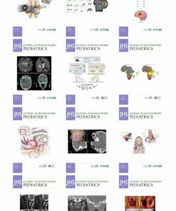 Journal of Neurosurgery: Pediatrics 2024 Full Archives (True PDF)
